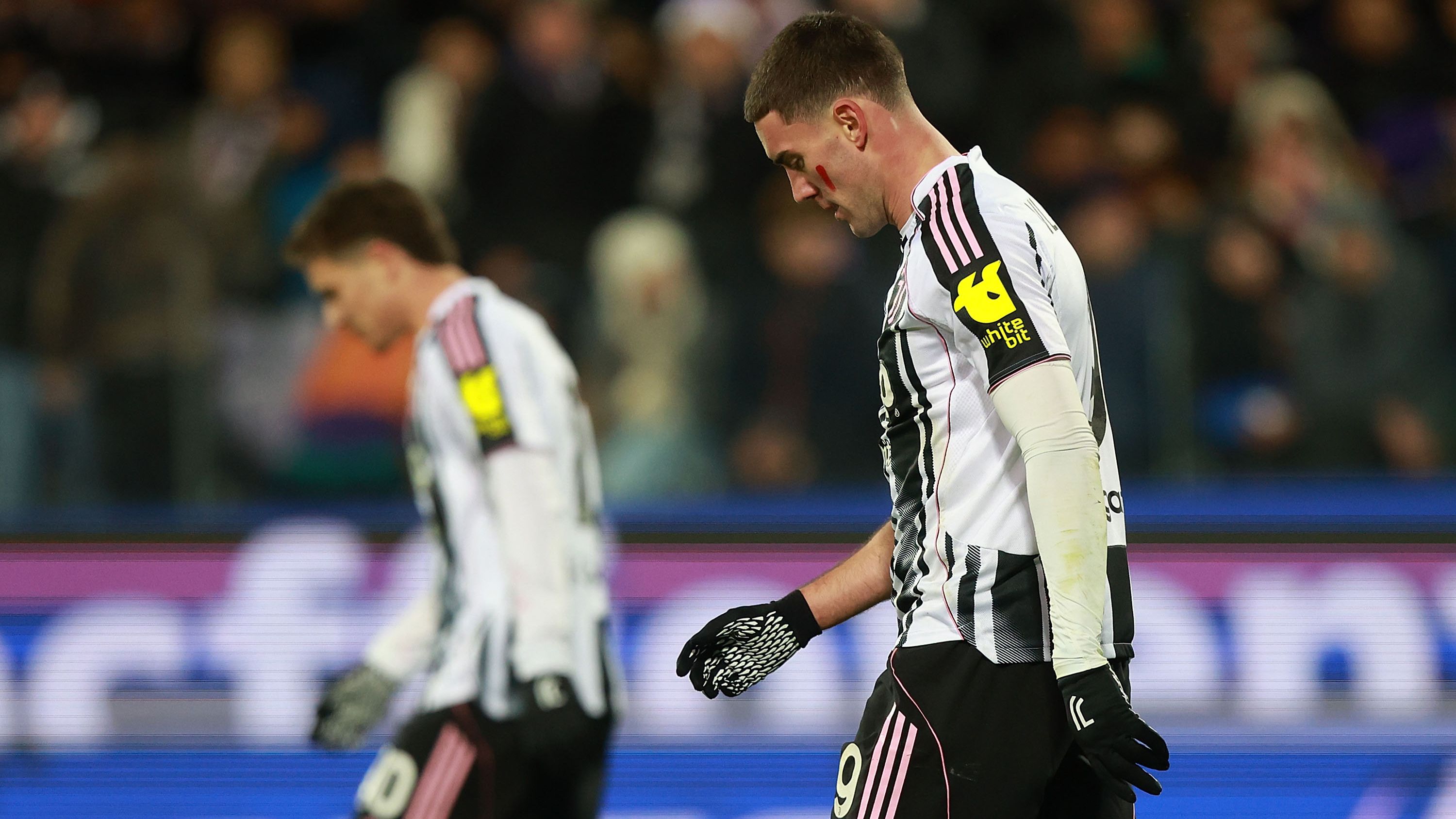 Spalletti Warns Juventus Players of Champions League Challenges Amid Brutal Weather and Pitch Concerns